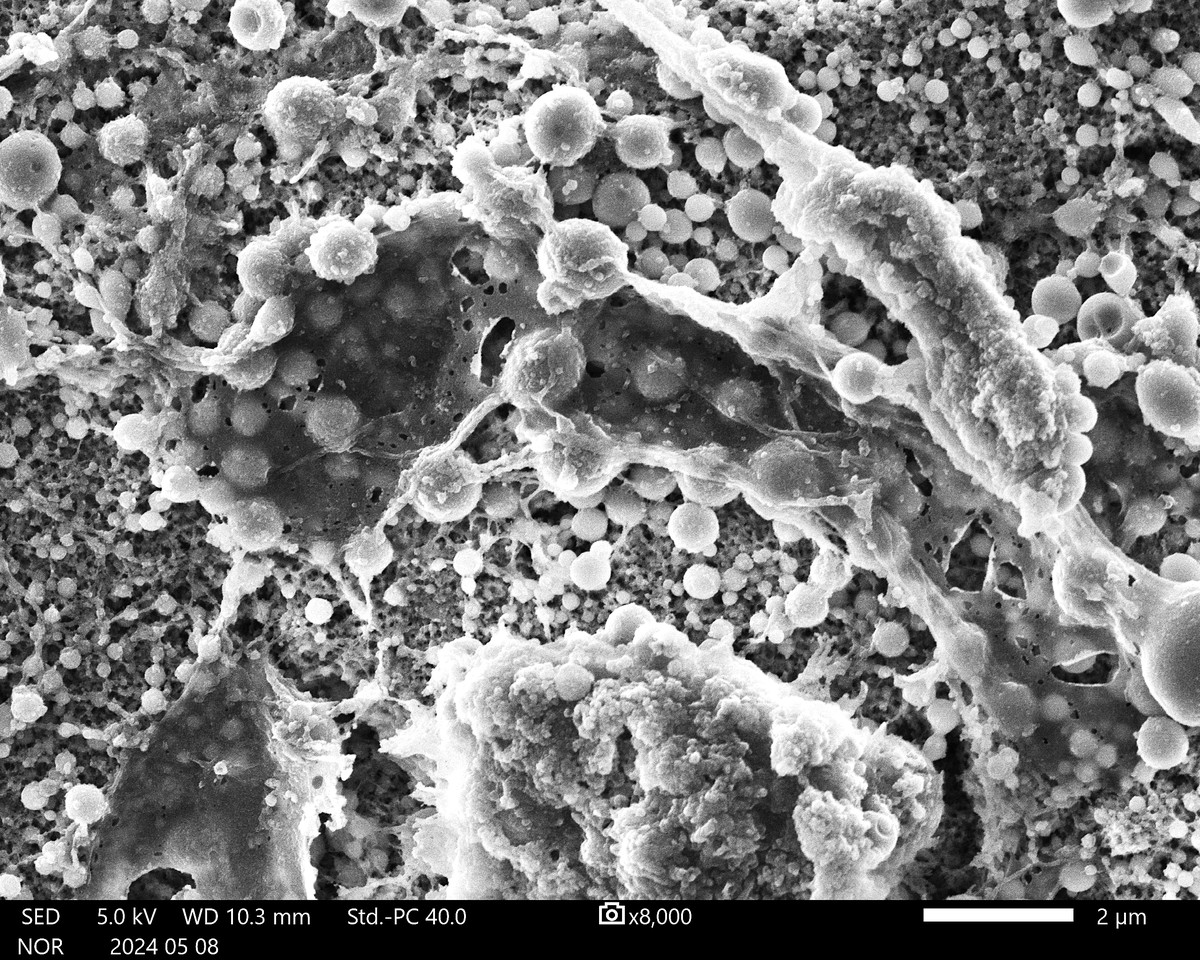 Scanning electron microscopy of Staphylococcus aureus biofilm architecture on a titanium implant surface