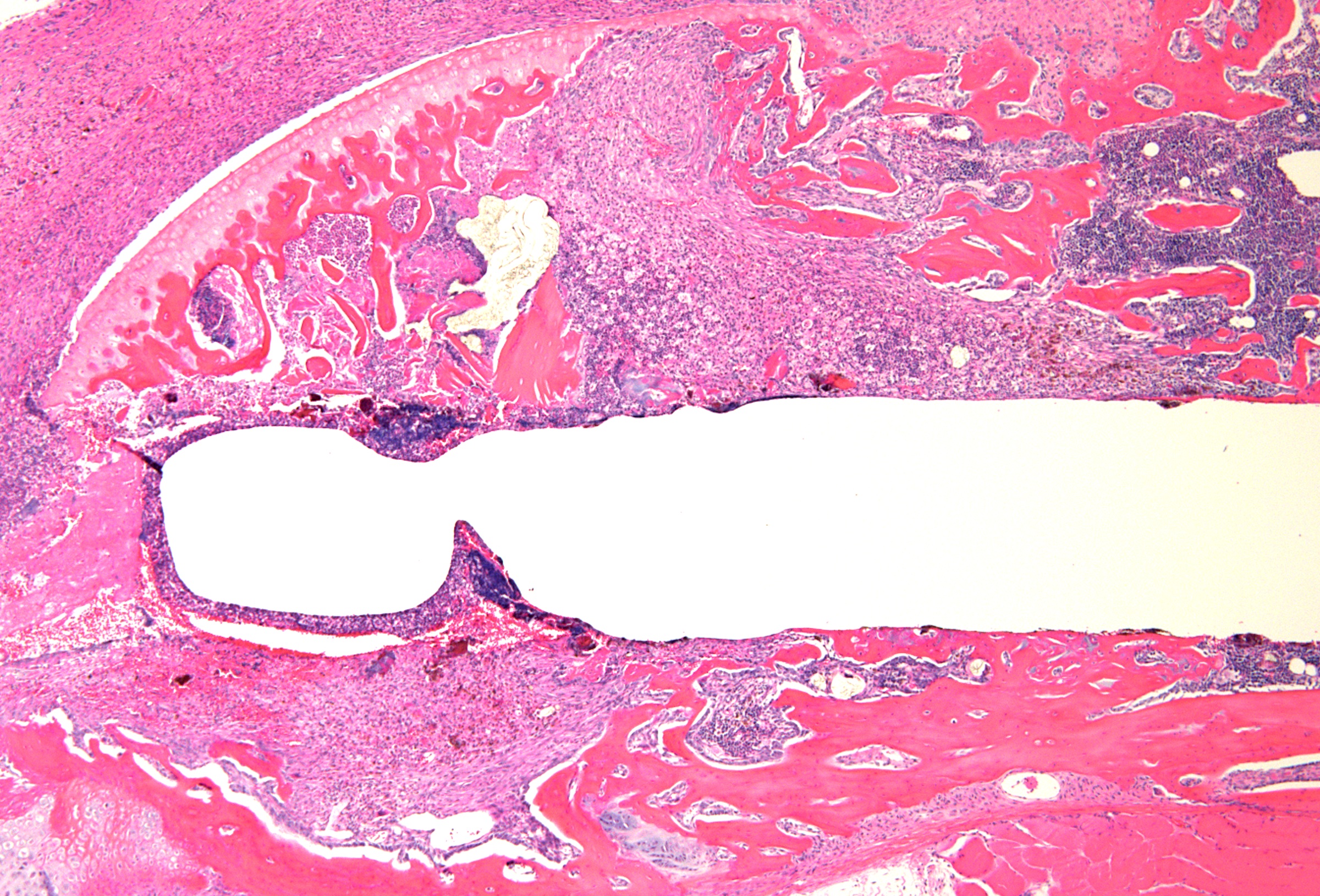 H&E histology of bone and periprosthetic tissue of distal femur harvested from a mouse model of periprosthetic joint infection