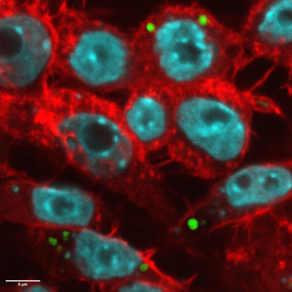 Confocal microscopy of intracellular MRSA-GFP (green) within host cells; nuclei stained with DAPI (cyan) and actin (red)