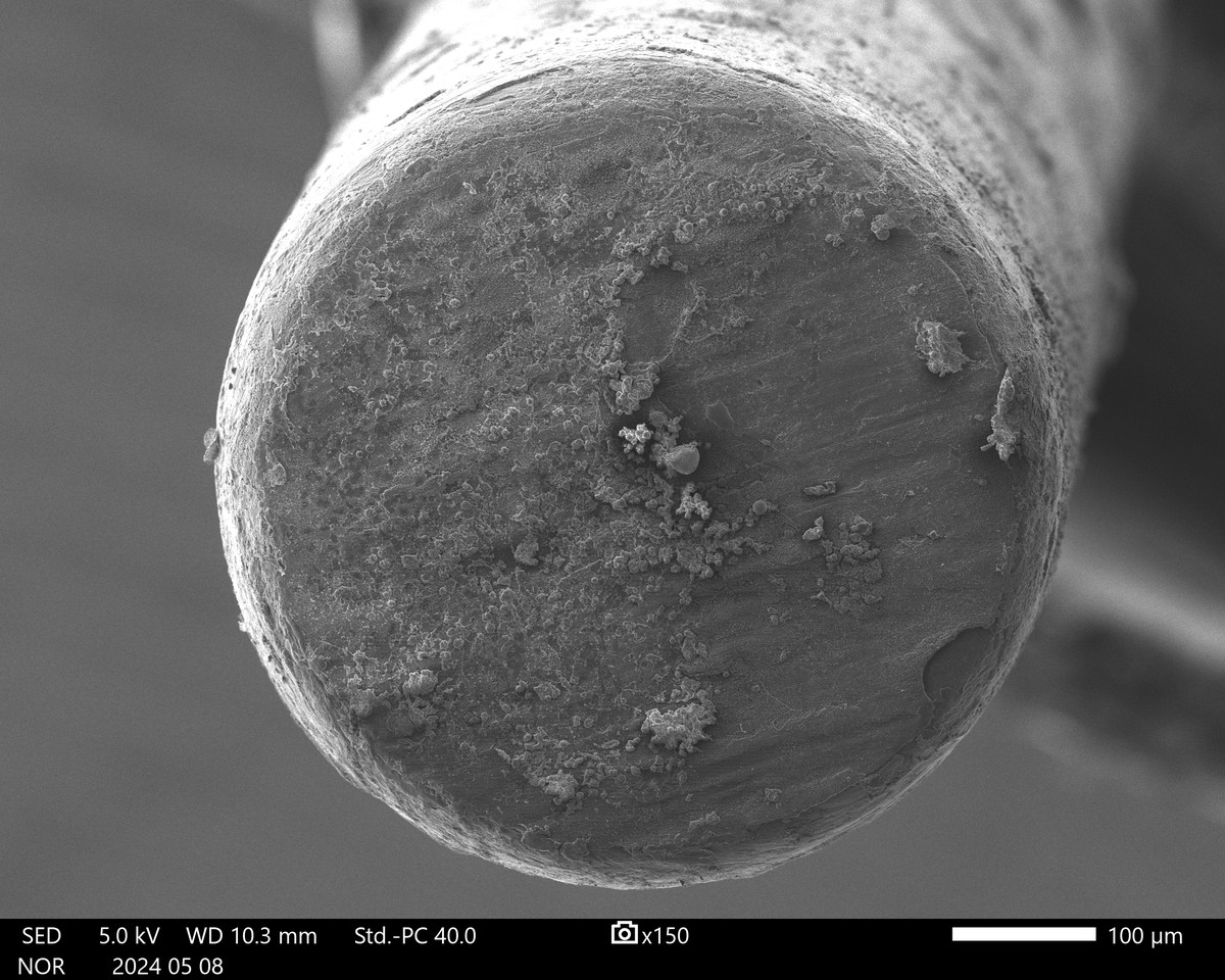Scanning electron micrograph of a coated and infected orthopedic implant surface harvested from a mouse model of periprosthetic joint infection